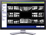 Digital X-Ray Technology at Somers NY Dentist Somers Smiles